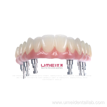 Full Arch Zirconia Malo Bridge